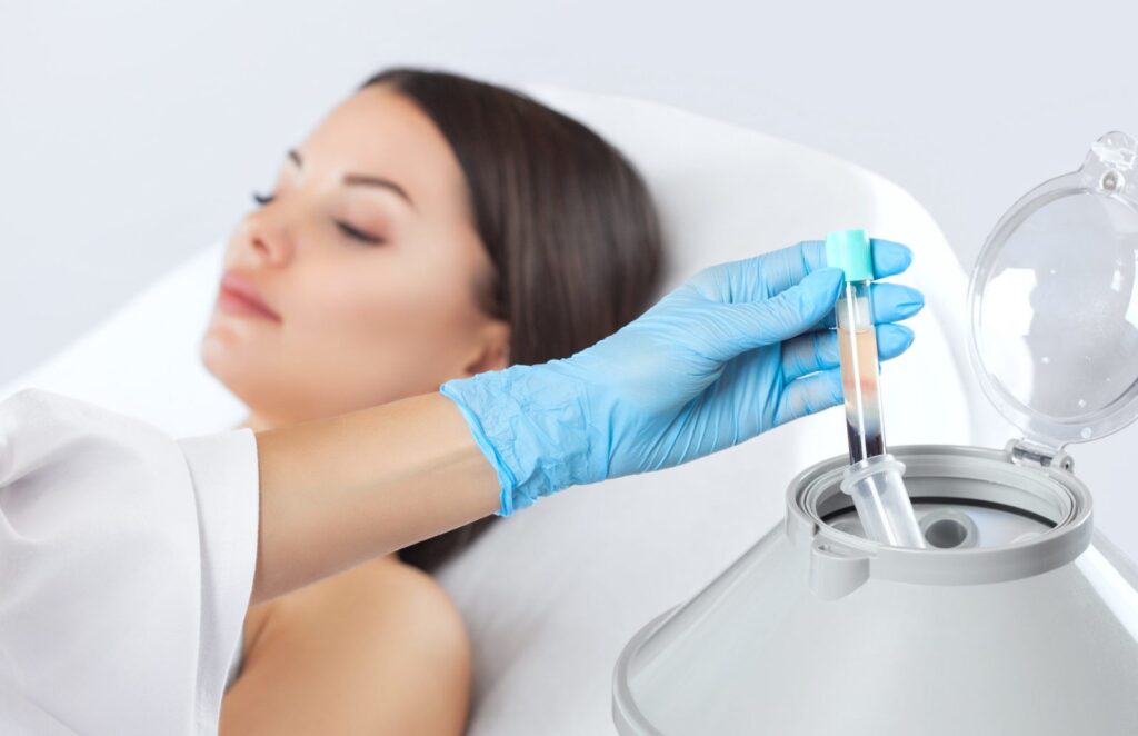 South Korean Platelet Rich Plasma (PRP) Market Poised for Robust Growth, Anticipated to Reach 8% CAGR Through 2034 – FMIBlog
