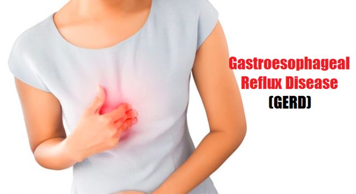 Global Gastroesophageal Reflux Disease (GERD) Device Market Set to Grow Significantly USD 1,719.5 Million by 2034 – FMIBlog