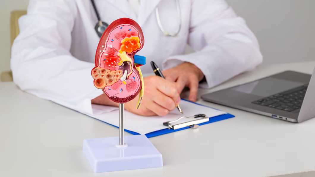 Kidney Specialist in Dwarka: Expert Care for Your Renal Heal – SmallBizBlog