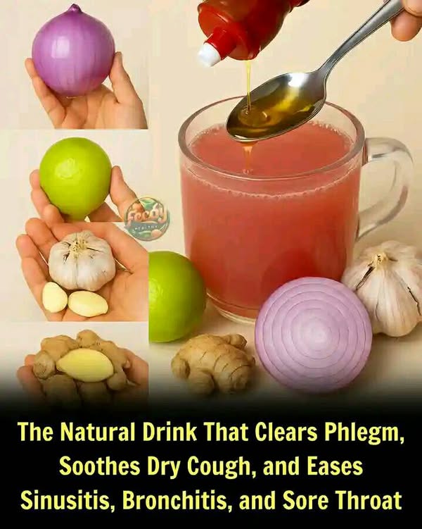 Role of Natural Remedies in Clearing Mucus - Health Link Pharmacy