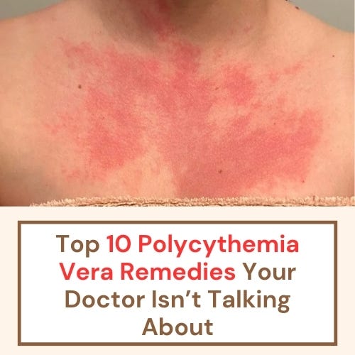 Top 10 Polycythemia Vera Remedies Your Doctor Isn’t Talking About | by Harry William | May, 2025 | Medium