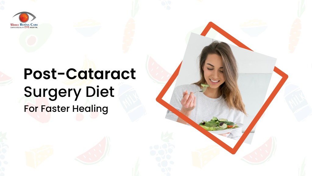 Post-Cataract Surgery Diet For Faster Healing -